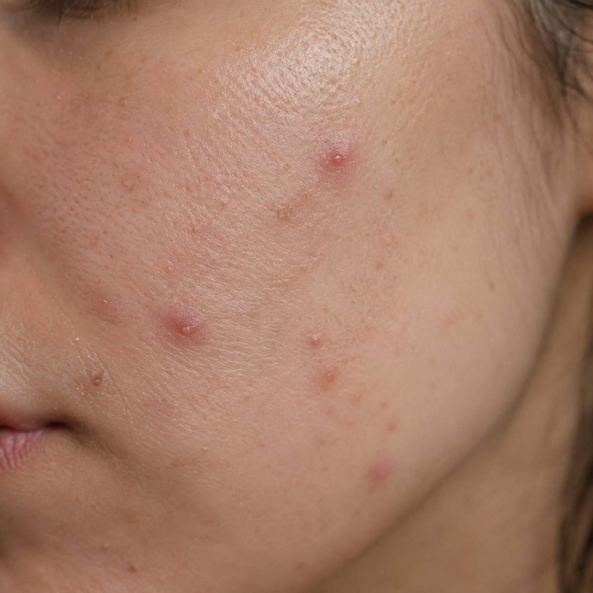Before skincare result