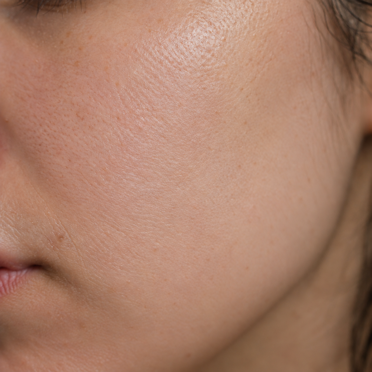 After skincare result